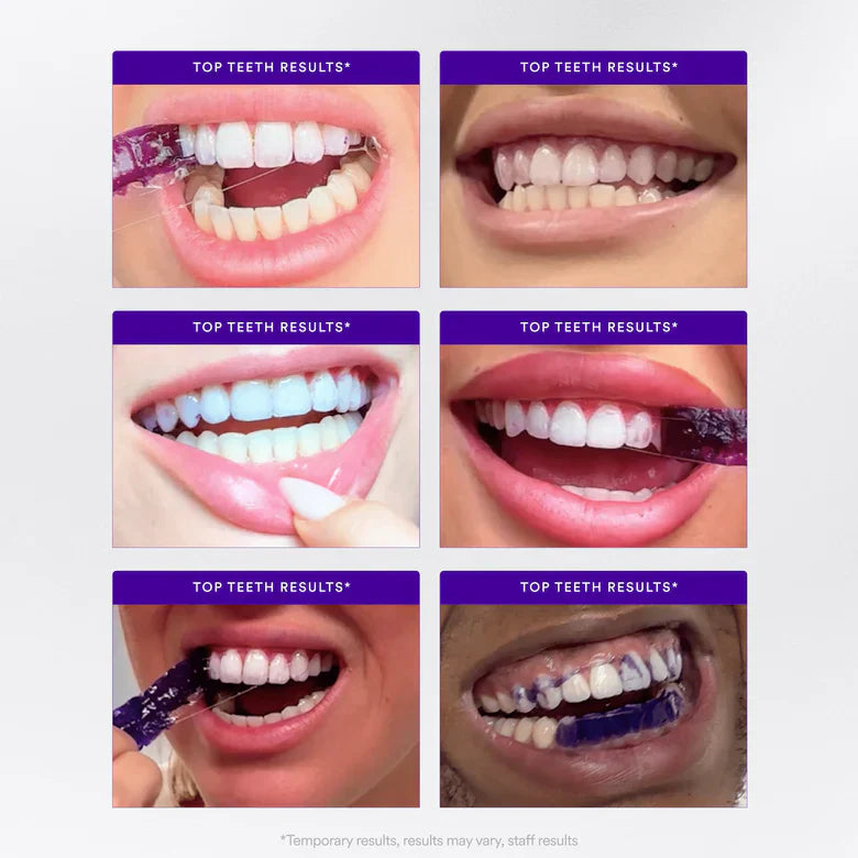 BBOJI™ PAP+ WHITENING Teeth whitening strips