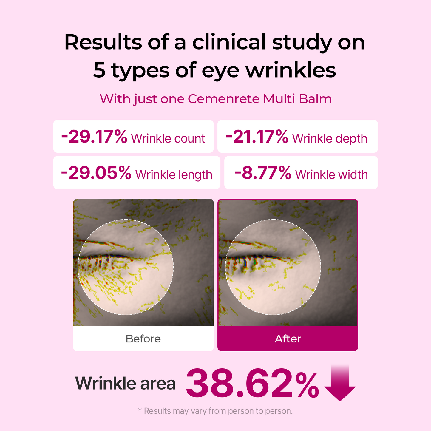 🌟70%OFF✨ Cemenrete Calcium Multi Balm | Anti-aging, Sagging, Wrinkles | Korean Cosmetics💖